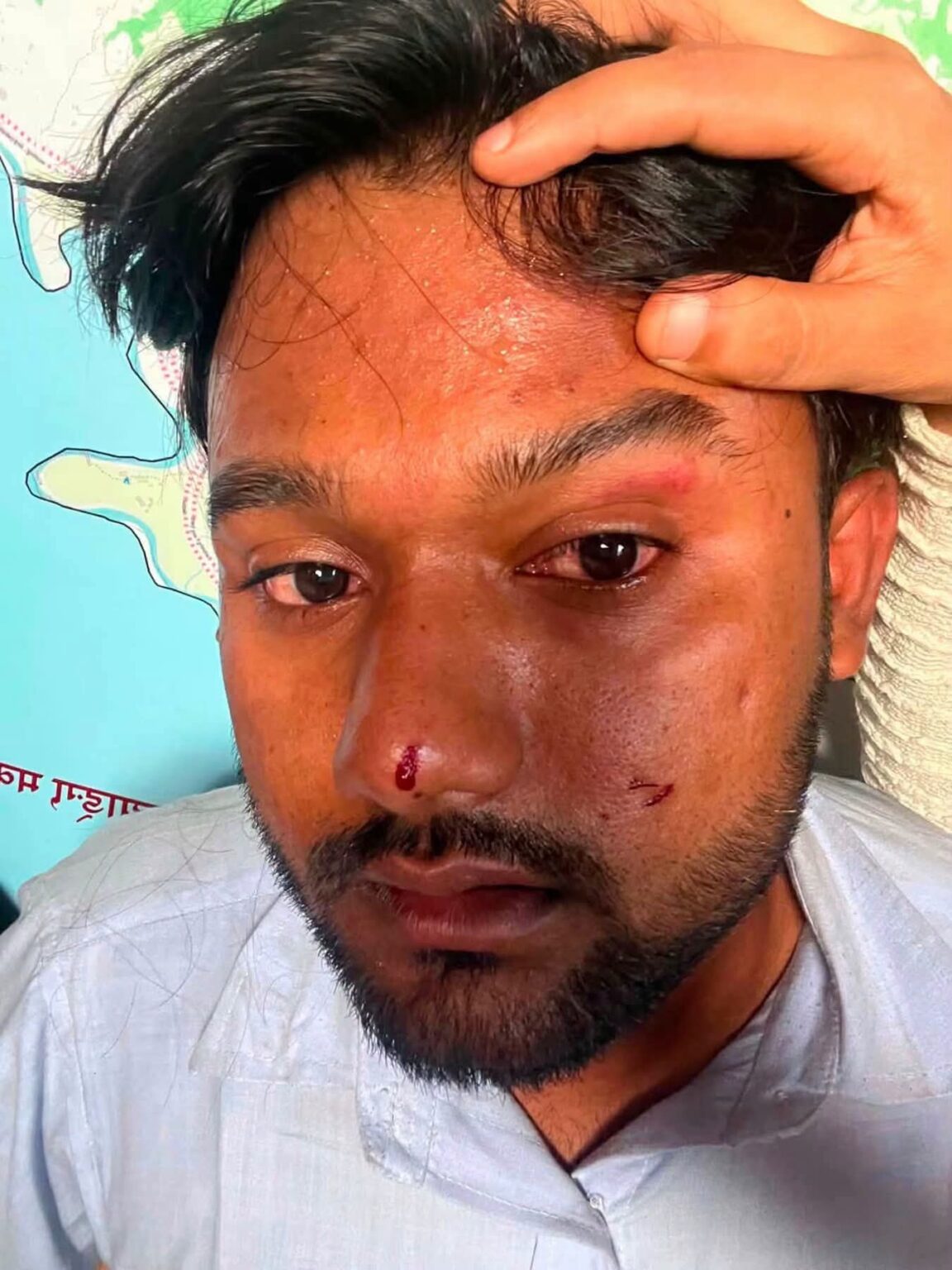अस्पतालबाटै जेनजी अभियन्ता माजिद अन्सारीले गरे सरकारसँग जीवनरक्षाको माग